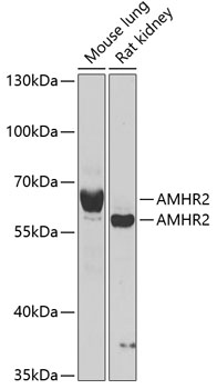 Anti-AMHR2 Antibody (CAB6523)