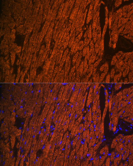 Anti-MYL2 Antibody (CAB5473)