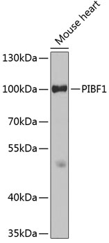 Anti-PIBF1 Antibody (CAB3072)