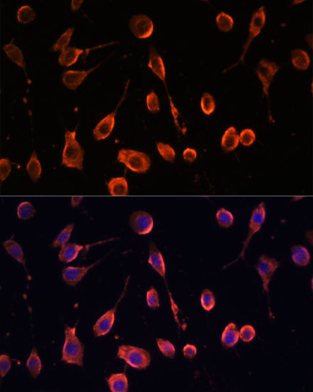 Anti-MT-ATP6 Antibody (CAB18315)