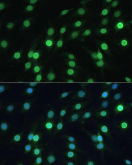 Anti-LBR Antibody (CAB5468)