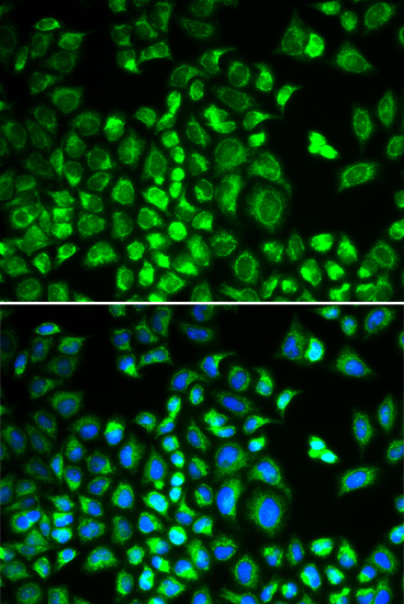 Anti-HAX1 Antibody (CAB5551)