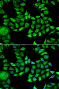 Anti-ANXA5 Antibody (CAB13945)