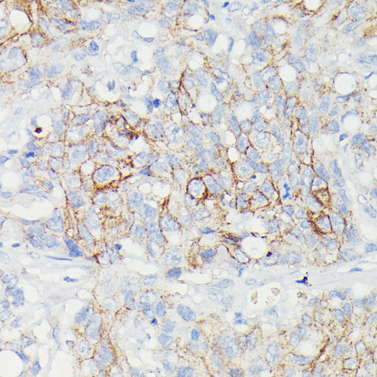 Anti-SLC14A1 Antibody (CAB15991)