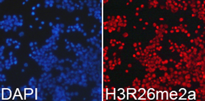 Anti-Asymmetric DiMethyl-Histone H3-R26 Antibody (CAB2375)