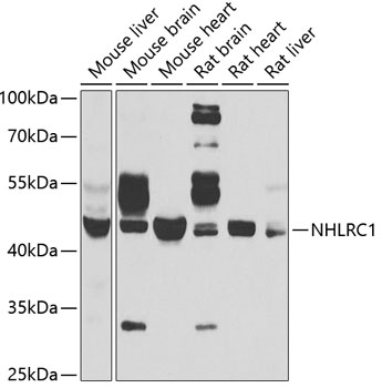 Anti-NHLRC1 Antibody (CAB6669)