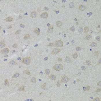 Anti-HSD17B13 Antibody (CAB6256)