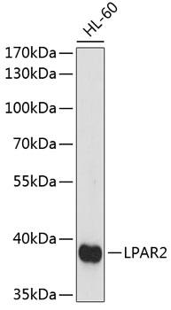 Anti-LPAR2 Antibody (CAB14819)