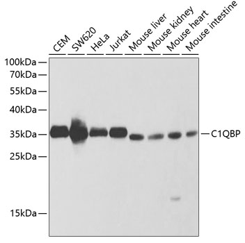 Anti-C1QBP Antibody (CAB1883)