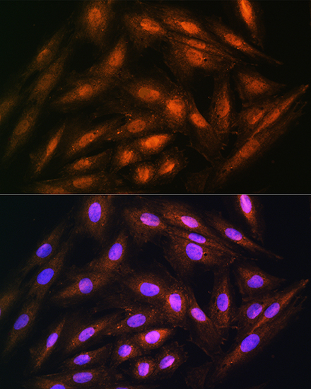 Anti-DUSP14 Antibody (CAB10287)