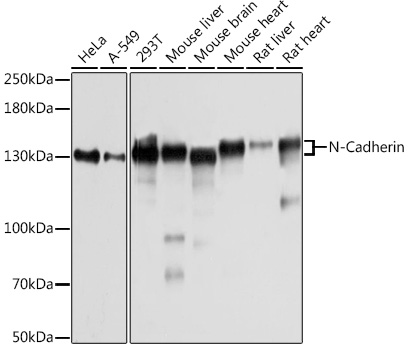 Anti-N-Cadherin Antibody [KO Validated] (CAB3045)