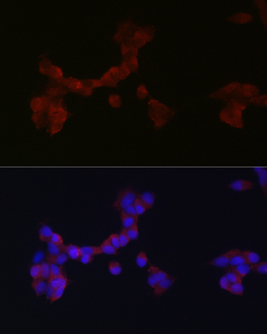 Anti-DAB1 Antibody (CAB10349)