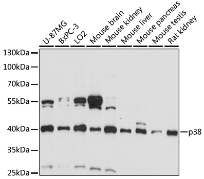 Anti-MAPK14 Antibody (CAB16822)