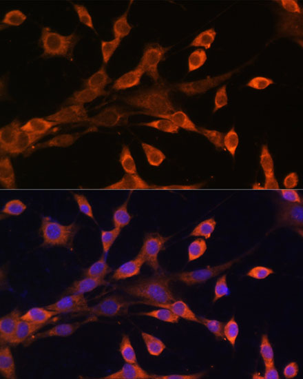 Anti-PRKAR1A Antibody (CAB0906)