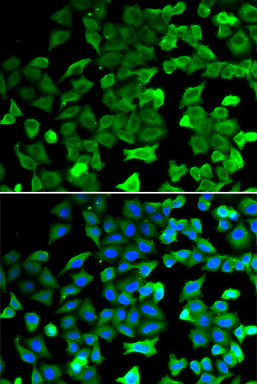 Anti-SIRT2 Antibody (CAB0273)