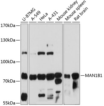 Anti-MAN1B1 Antibody (CAB13784)