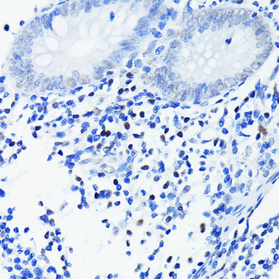 Anti-PARP Antibody [KO Validated] (CAB19596)