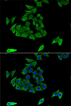 Anti-TGM3 Antibody (CAB5856)