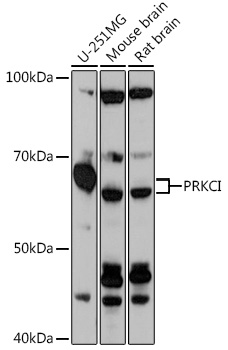 Anti-PRKCI Antibody (CAB18348)