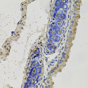 Anti-INHBB Polyclonal Antibody (CAB8553)