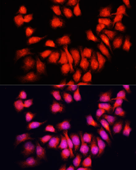 Anti-BMP6 Polyclonal Antibody (CAB8333)