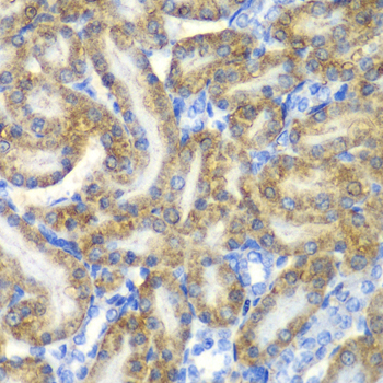 Anti-FAH Antibody (CAB13492)