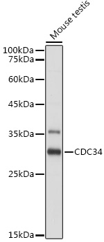 Anti-CDC34 Antibody (CAB5457)