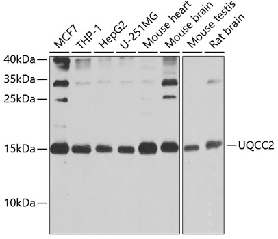 Anti-UQCC2 Polyclonal Antibody (CAB9986)