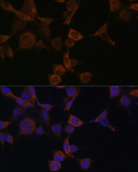 Anti-AMPKBeta1 Antibody [KO Validated] (CAB12491)