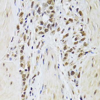 Anti-SF1 Antibody (CAB6424)