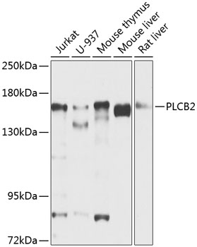 Anti-PLCB2 Polyclonal Antibody (CAB8141)