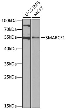 Anti-SMARCE1 Antibody [KO Validated] (CAB13353)