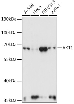 Anti-AKT1 Antibody (CAB11016)