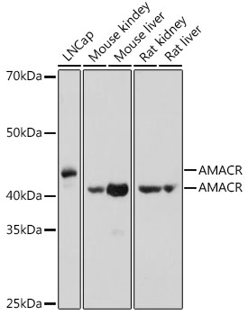 Anti-AMACR Antibody (CAB1130)