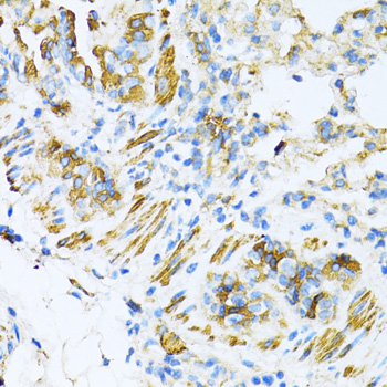 Anti-VAMP1 Polyclonal Antibody (CAB8877)