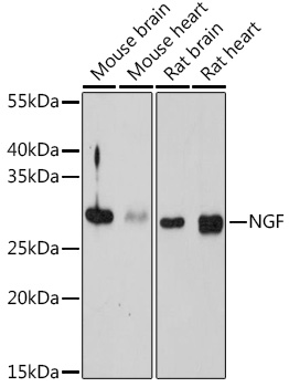 Anti-NGF Antibody (CAB14216)