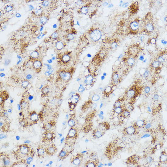 Anti-IGF2BP3 Antibody (CAB6099)