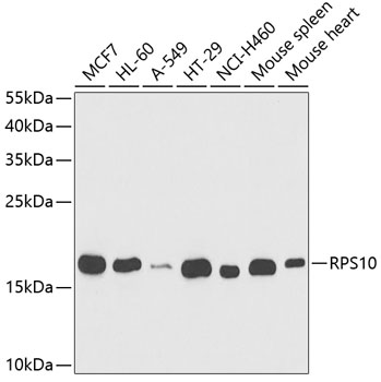 Anti-RPS10 Antibody (CAB5880)