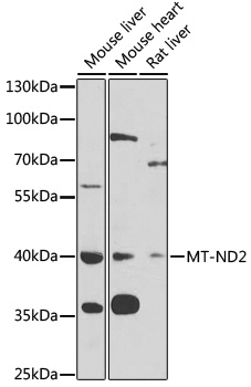 Anti-MT-ND2 Antibody (CAB6180)
