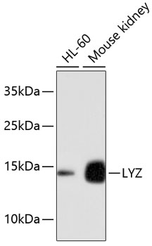 Anti-LYZ Antibody (CAB10972)