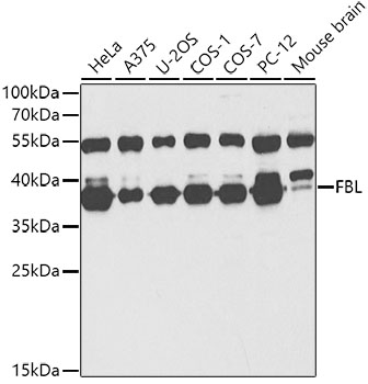 Anti-FBL Antibody (CAB13490)