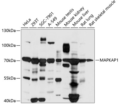 Anti-MAPKAP1 Antibody (CAB6648)