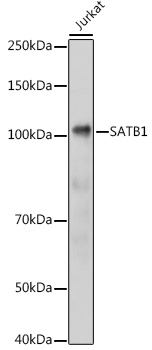Anti-SATB1 Antibody (CAB5800)