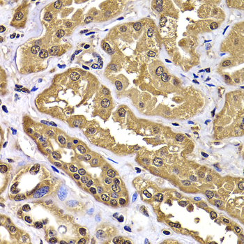 Anti-WBSCR22 Antibody (CAB7317)