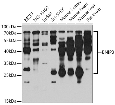Anti-BNIP3 Antibody (CAB5683)