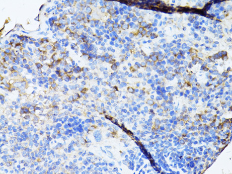 Anti-TEFM Polyclonal Antibody (CAB8511)