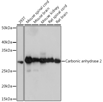 Anti-Carbonic anhydrase 2 Antibody (CAB9148)