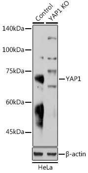 Anti-YAP1 Antibody [KO Validated] (CAB11264)