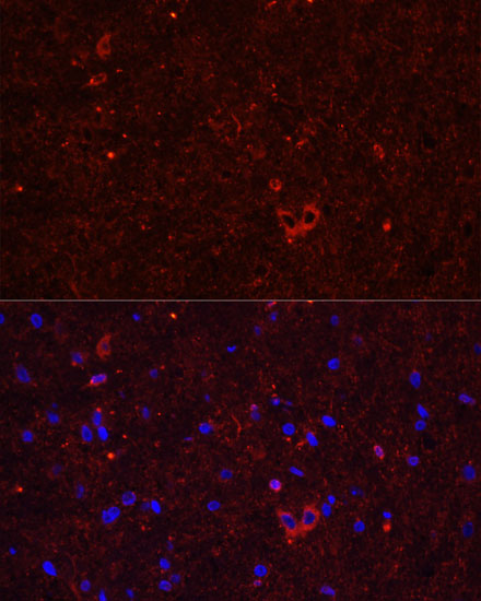 Anti-GRIA2 Antibody (CAB0111)