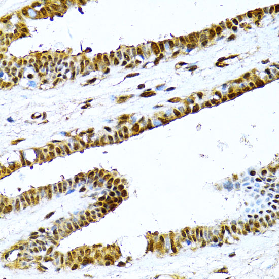 NF-kB2 Rabbit Polyclonal Antibody (CAB3108)